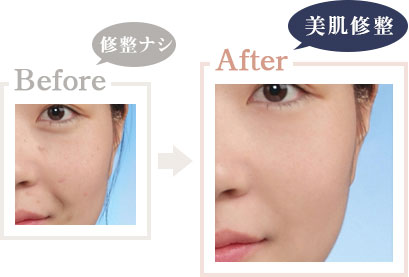 美肌修整 Before After